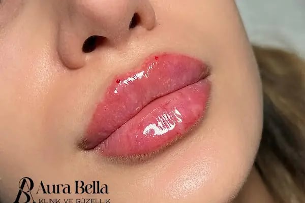 Aura Bella Klinik ve Güzellik Gaziantep - Resim 16