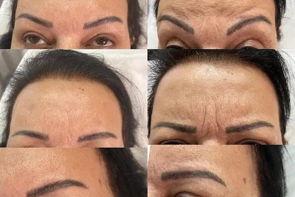 Aura Bella Klinik ve Güzellik Gaziantep - Resim 7