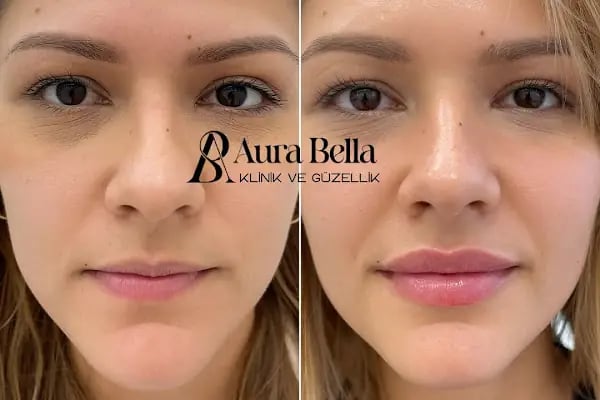 Aura Bella Klinik ve Güzellik Gaziantep - Resim 10