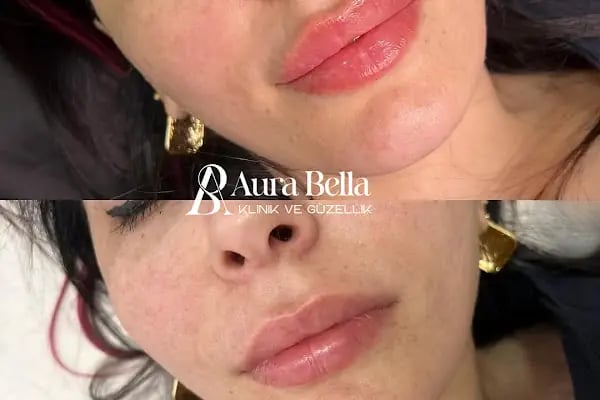 Aura Bella Klinik ve Güzellik Gaziantep - Resim 20