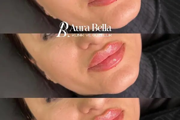 Aura Bella Klinik ve Güzellik Gaziantep - Resim 15
