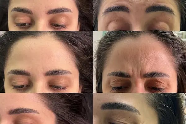 Aura Bella Klinik ve Güzellik Gaziantep - Resim 2