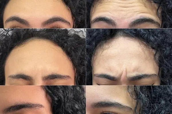 Aura Bella Klinik ve Güzellik Gaziantep - Resim 6