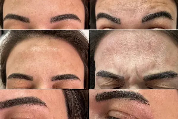 Aura Bella Klinik ve Güzellik Gaziantep - Resim 4