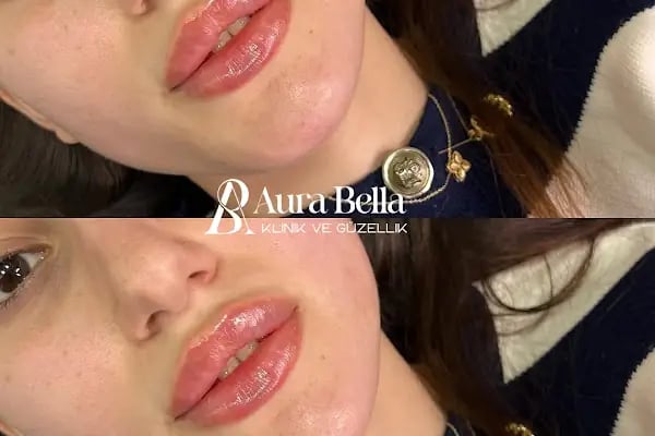 Aura Bella Klinik ve Güzellik Gaziantep - Resim 12