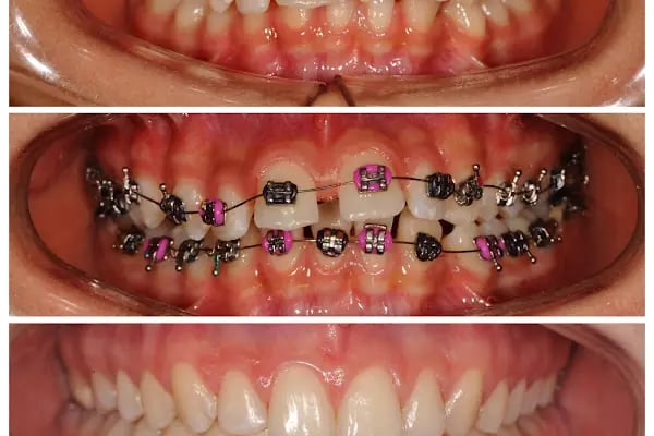 Dr. Vecdi Bulut Dental Klinik - Resim 14