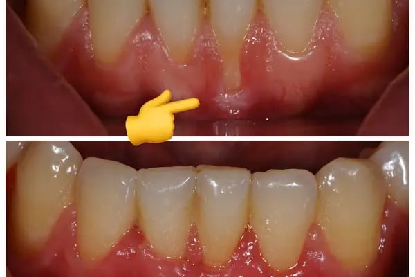 Dr. Vecdi Bulut Dental Klinik - Resim 19