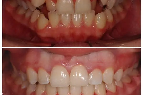 Dr. Vecdi Bulut Dental Klinik - Resim 16