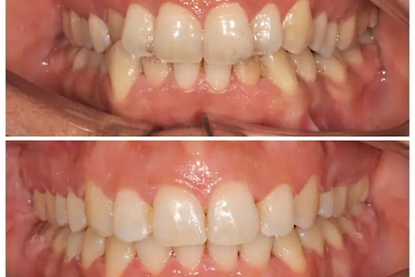 Dr. Vecdi Bulut Dental Klinik - Resim 17