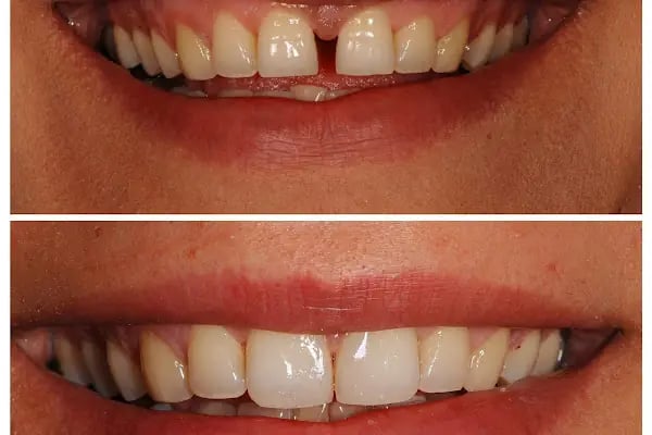 Dr. Vecdi Bulut Dental Klinik - Resim 15