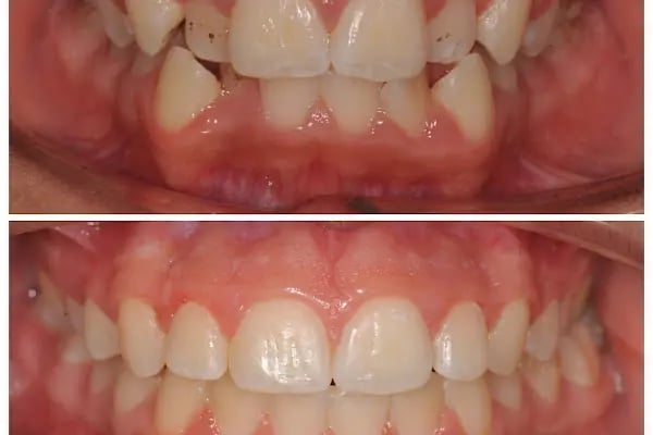 Dr. Vecdi Bulut Dental Klinik - Resim 18