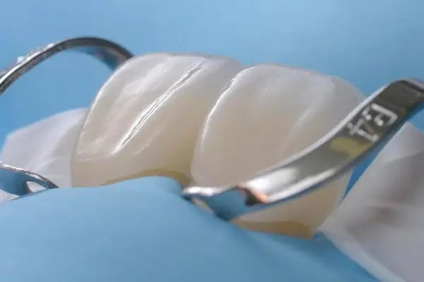 Özel Balıkesir Dentmaks Ağız ve Diş Sağlığı Polikliniği - Hastanesi / invisalign - implant - lamine - Resim 11