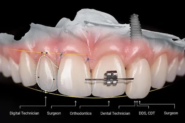 Özel Balıkesir Dentmaks Ağız ve Diş Sağlığı Polikliniği - Hastanesi / invisalign - implant - lamine - Resim 2