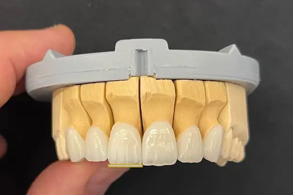 Özel Balıkesir Dentmaks Ağız ve Diş Sağlığı Polikliniği - Hastanesi / invisalign - implant - lamine - Resim 9