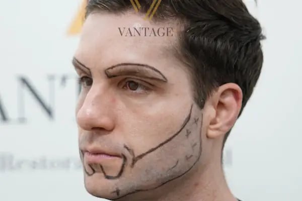 Vantage Hair - Resim 6