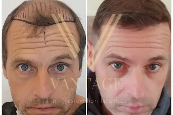 Vantage Hair - Resim 15