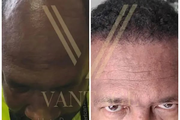 Vantage Hair - Resim 16