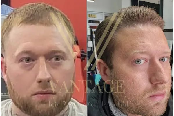 Vantage Hair - Resim 18