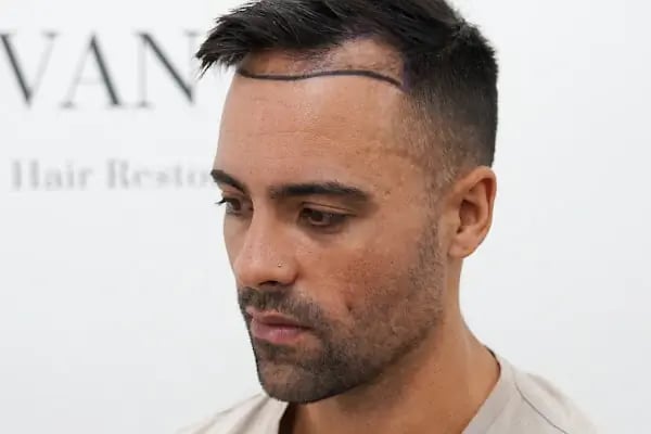 Vantage Hair - Resim 3