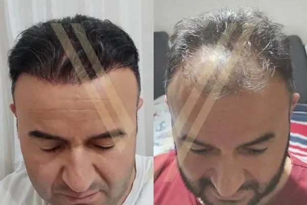 Vantage Hair - Resim 1