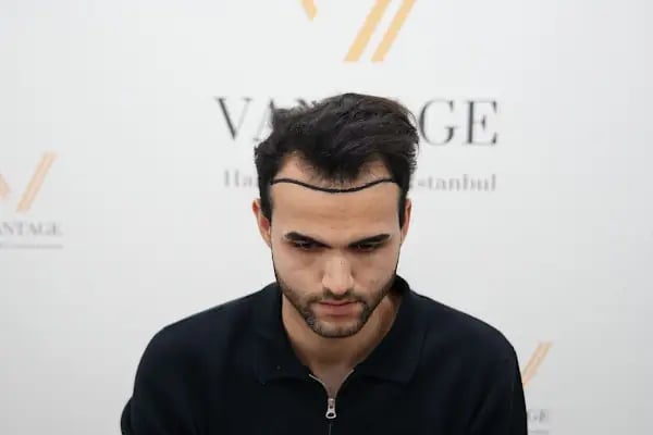 Vantage Hair - Resim 2