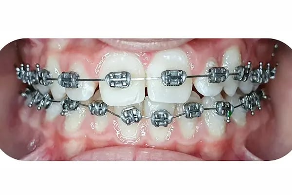 Özel Özdemir Dental Klinik Ağız ve Diş Sağlığı Polikliniği - Resim 4