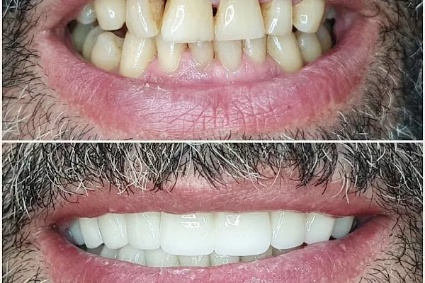 Özel Özdemir Dental Klinik Ağız ve Diş Sağlığı Polikliniği - Resim 1