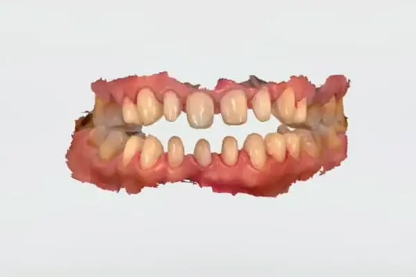 Özel Özdemir Dental Klinik Ağız ve Diş Sağlığı Polikliniği - Resim 13