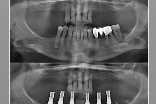Özel Özdemir Dental Klinik Ağız ve Diş Sağlığı Polikliniği - Resim 11