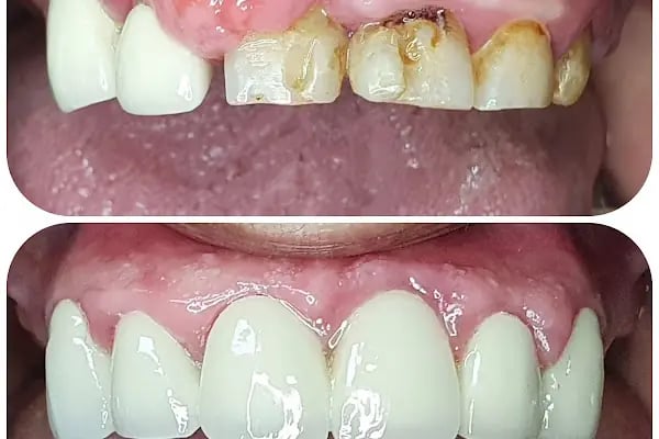Özel Özdemir Dental Klinik Ağız ve Diş Sağlığı Polikliniği - Resim 16