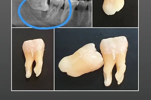 Özel Özdemir Dental Klinik Ağız ve Diş Sağlığı Polikliniği - Resim 12