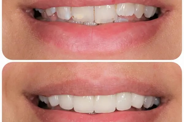 Özel Özdemir Dental Klinik Ağız ve Diş Sağlığı Polikliniği - Resim 20