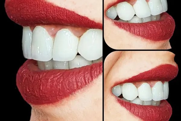 Özel Özdemir Dental Klinik Ağız ve Diş Sağlığı Polikliniği - Resim 6