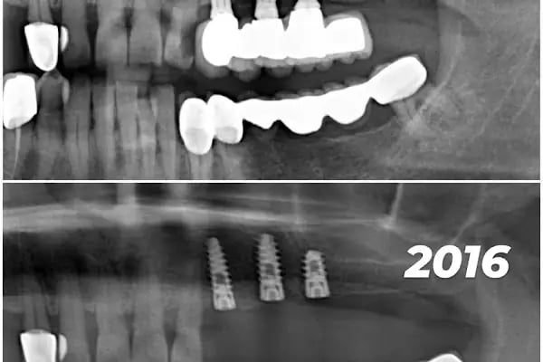 Özel Özdemir Dental Klinik Ağız ve Diş Sağlığı Polikliniği - Resim 10