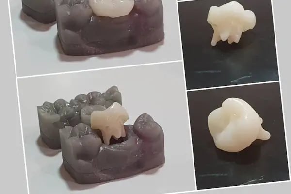Özel Özdemir Dental Klinik Ağız ve Diş Sağlığı Polikliniği - Resim 8