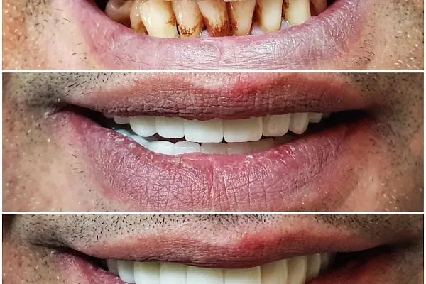 Özel Özdemir Dental Klinik Ağız ve Diş Sağlığı Polikliniği - Resim 18