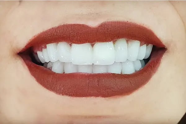 Özel Özdemir Dental Klinik Ağız ve Diş Sağlığı Polikliniği - Resim 3