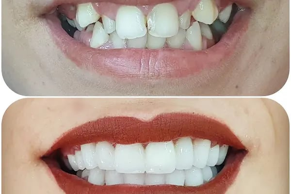 Özel Özdemir Dental Klinik Ağız ve Diş Sağlığı Polikliniği - Resim 9