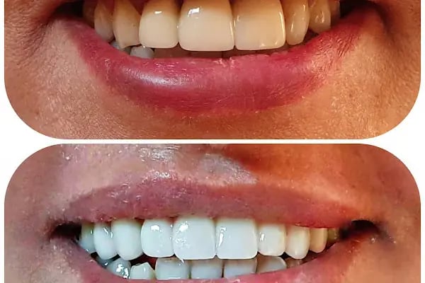 Özel Özdemir Dental Klinik Ağız ve Diş Sağlığı Polikliniği - Resim 19