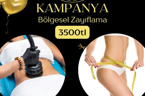 Fatma Erdem episima güzellik - Resim 10