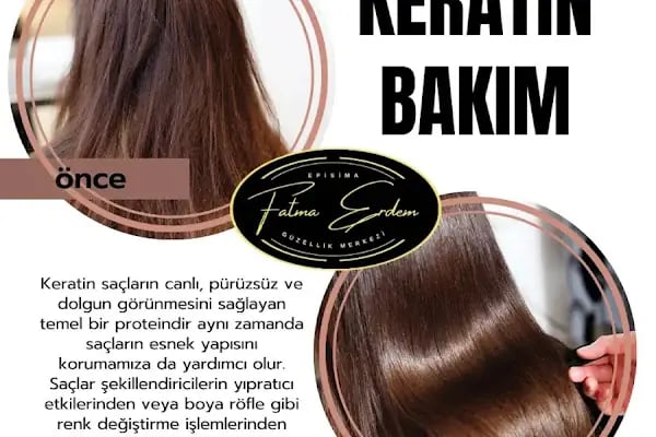 Fatma Erdem episima güzellik - Resim 3