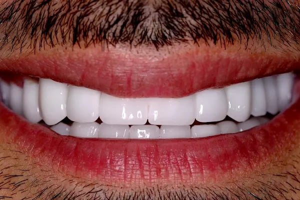 BÜYÜKGEBİZ Diş Polikliniği - Resim 1
