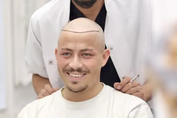 Panorama Hair Turkey - Resim 17