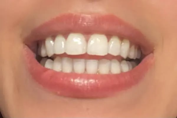 Özel Ataşehir Diş Kliniği - Dent Ataşehir Ağız ve Diş Sağlığı Polikliniği - Resim 12