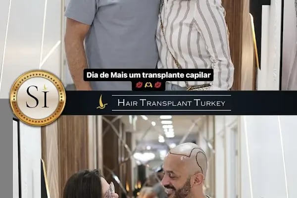 Si Hair Transplant in Turkey - Resim 12