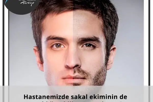 Saç ekimi Türkiye - Resim 13