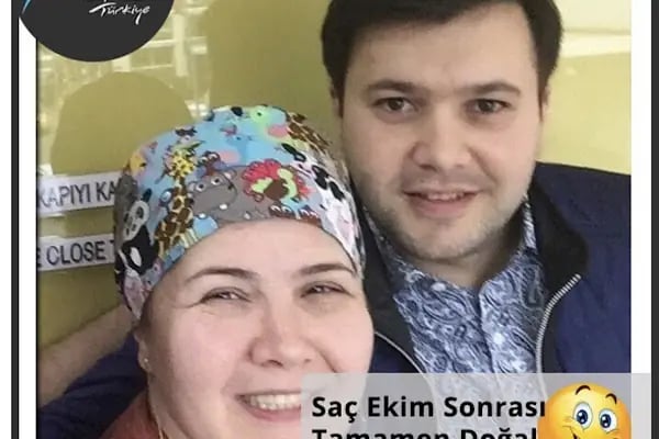 Saç ekimi Türkiye - Resim 20