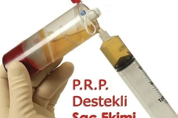 Saç Ekimi(Naturel) - Resim 1