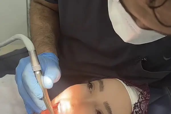 Özel Dentexpert Mahmutbey Ağız ve Diş Sağlığı Polikliniği - Resim 3