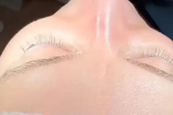 Dr. Çiğdem Özden - Lip Filler | Botox | Thread Lift | Fat Dissolving | Jawline Filler | Fox Eyes | IV Drip &amp; Vitamin - Resim 11